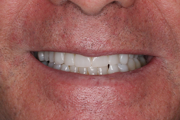 Clínica Antequera y Cerón - Antes despues Caso 2 - Despues